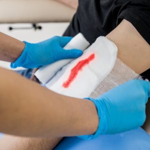 Safety Mode Ltd First Aid wounds and bleeding